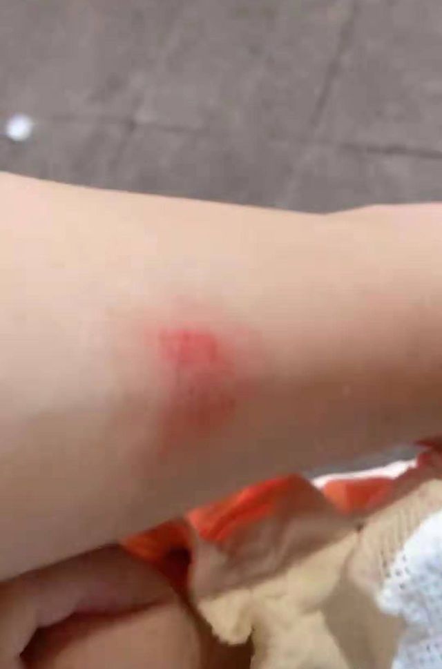 宝宝“吃奶的力气”到底有多大?宝妈用胳膊做实验,看完心疼妈妈