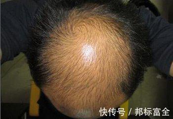 鼻毛|45岁之前，身体此处毛发变白，说明长寿与你无缘，别傻傻不清楚