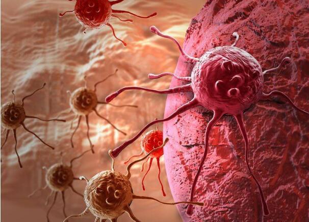 癌症|癌症患者若符合这3个条件,说明癌症治疗的不错,值得恭喜