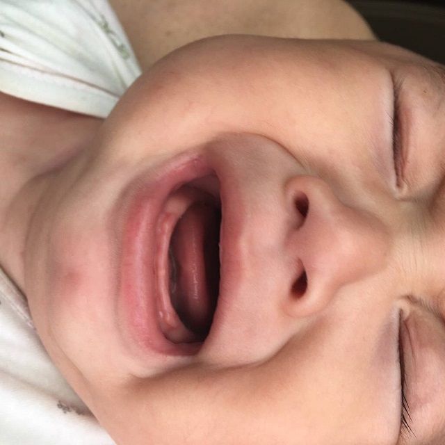 排便|孩子啥时候最难带这8个常见的问题,1岁前几乎所有孩子都有