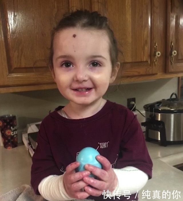 父母|父母每天将三岁女儿包裹成木乃伊，网友知道真相后感动落泪！