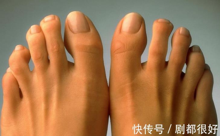 冬病夏治|80岁老中医:肾好不好,看脚就知道了,为健康早知早好!