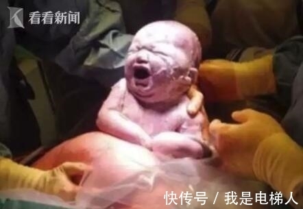 哪吒|医生从妈妈肚子里取出一个肉球！网友：这是哪吒啊