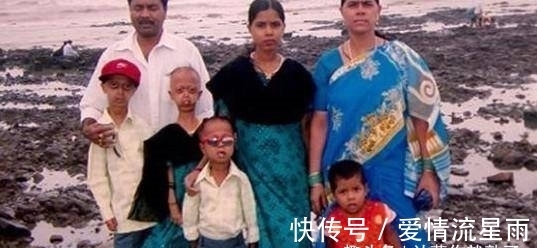 夫妇|【奇闻】印度夫妇生下6个“外星人”,求助医生,医生大骂:无知