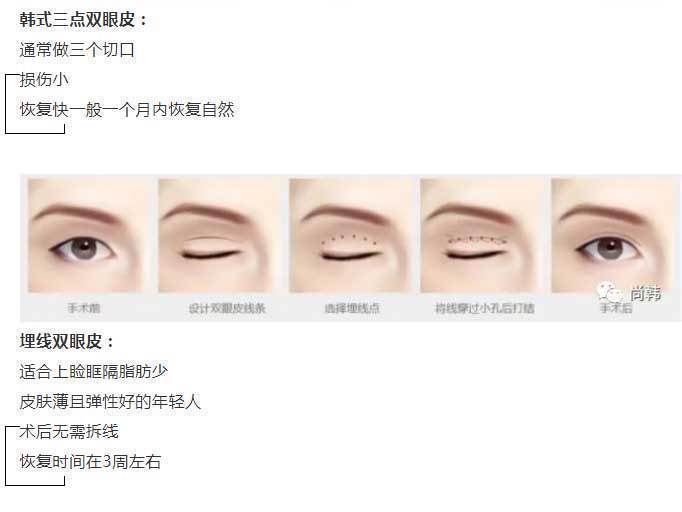 恢复|为啥割了双眼皮以后,你恢复的比别人慢