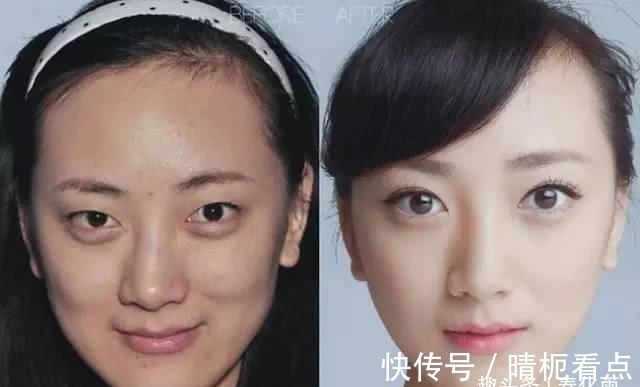 美白|实拍:10张女孩整容前后的对比照,这真就是换了一张脸