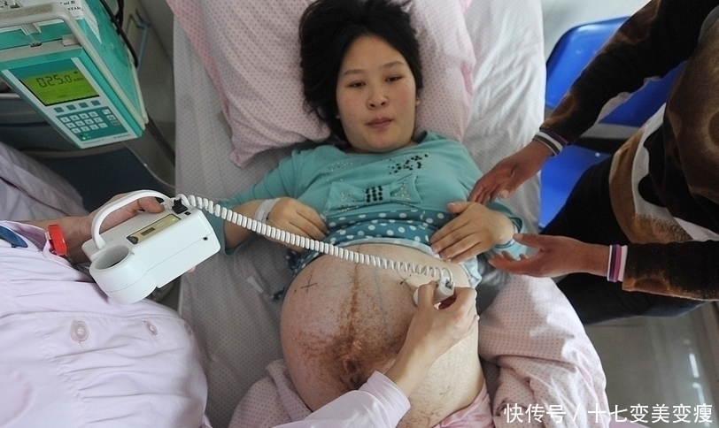 icu|21岁孕妇肚大如箩,医院派出了最强手术阵容,孩子取名健康平安