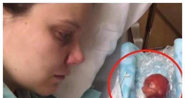 婴儿|还记得那个“世界最小的婴儿”吗14年过去后,如今美得认不出