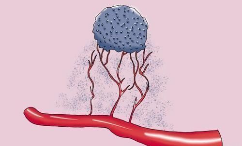 晚期|体检年年不落,为什么还是查出癌症晚期?医生毫不隐瞒说出真相