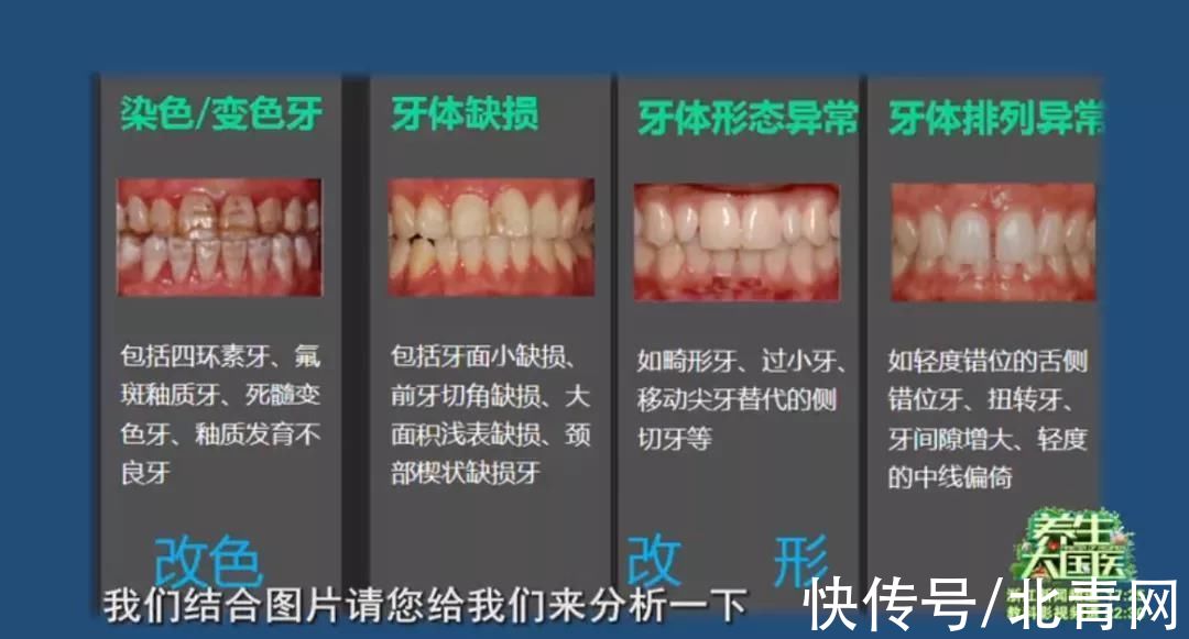 牙体|牙齿不美怎么办？专家告诉你明星一口好牙的秘密！保护牙齿“3做3不做”记好了
