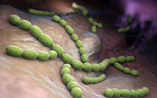 结肠癌|大肠癌的罪魁祸首已经找到，晨起坚持三个习惯，肠道才会更健康