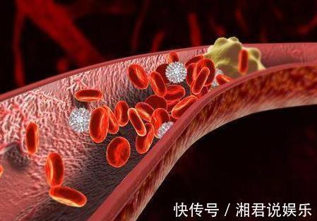 脑血栓|早上空腹喝下“此物”,坚持一周,排净血管多年毒素,血管不堵塞