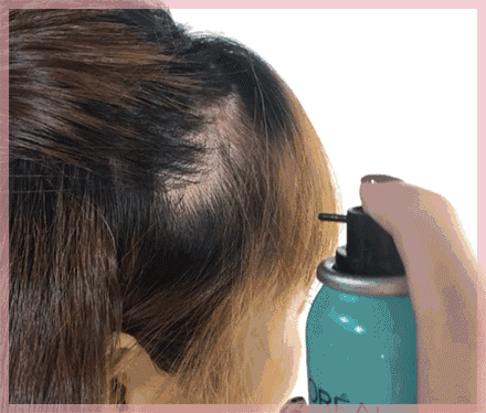 发际线|谁说发际线不够只能刘海来凑?你还可以这样做