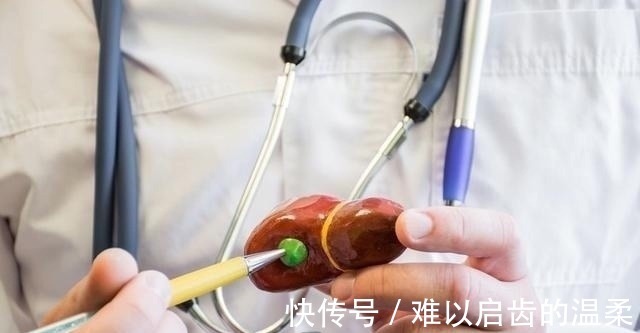 医生|切除胆囊，对身体有什么影响吗医生终于讲出大实话