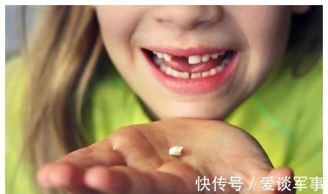 孩子换牙要不要干预?若碰上这些情况,最好能及早干预