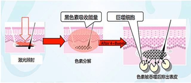 眼科医院|春节前这波操作，让TA刮目相看！