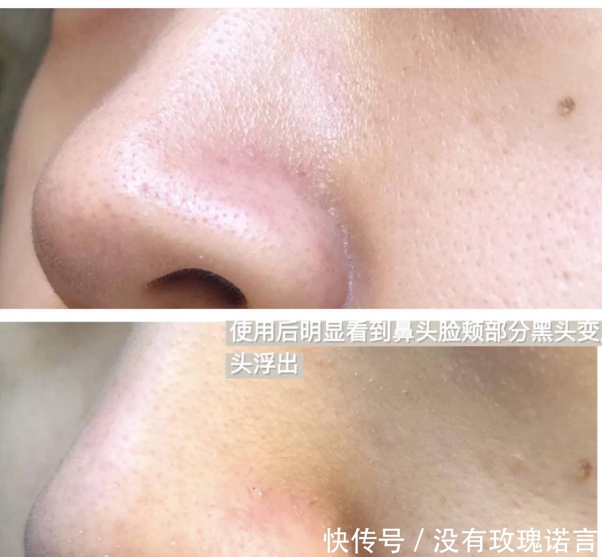 这些清洁面膜如果停产了，我简直世界崩塌！