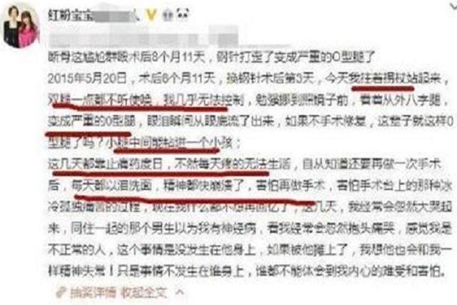 整容 她16岁开始整容,花400多万做过200多次手术,如今成了这样