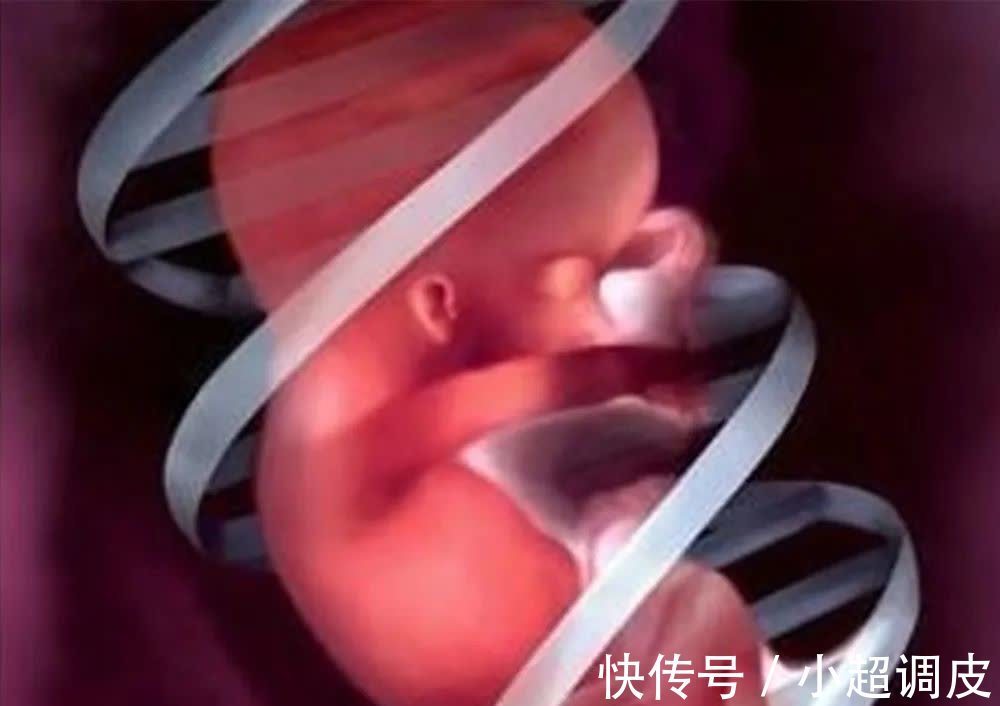 精神状态|生完宝宝后为啥医生问你“是男是女”,并非为难产妇,是另有目的