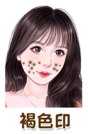 掌握6种痘印去除指南,不要“月球脸”,轻松养成“牛奶肌”