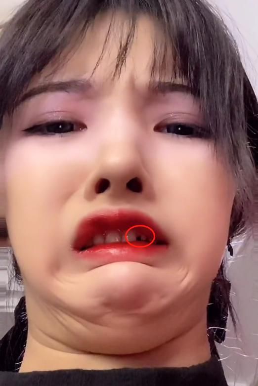 次惑小仙女跟可乐分手后,终于取出鼻子里的假体,颜值重回巅峰时期