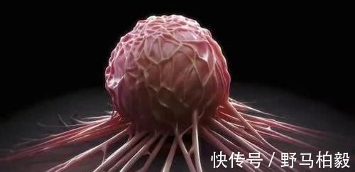 泡脚|不易“惹癌”的人，一般有5个共同点，全占的人是“癌症免疫体”