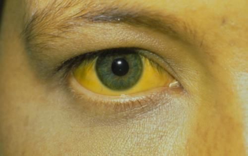 排毒|对肝好的食物，胡萝卜排不上号，一物可劲喝，养肝排毒，肝更强壮