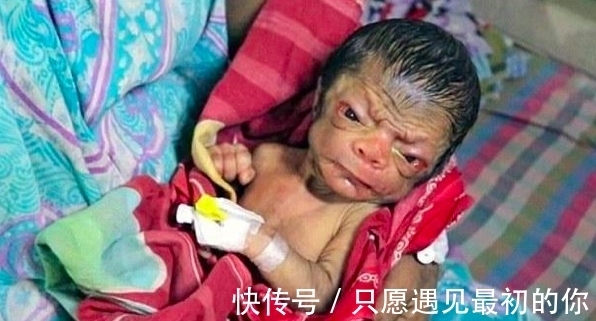 奇葩|国外奇葩婴儿“返老还童”,一出生如同80岁老头,父母不惊反喜!