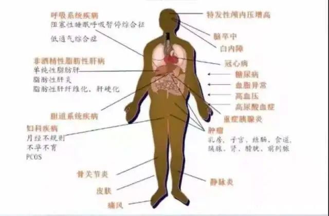 男子|男子两次被送入ICU，都是同一个原因！每年全球280万人因此丧生