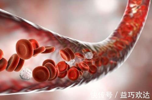 头晕头痛|血管堵，手先知，手上若有这4种表现，可能是血管堵了