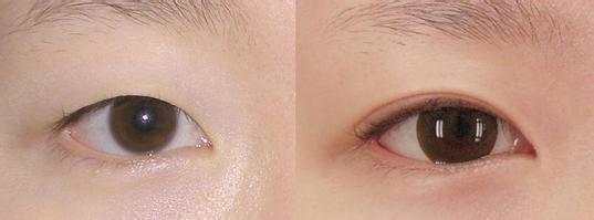 眼窝|眼睛有3个特点的女生,拍照不好看还显凶,没有灵气