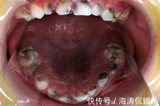女儿|家里这3种东西,比糖更易让孩子长出“黑牙”,家长应该了解
