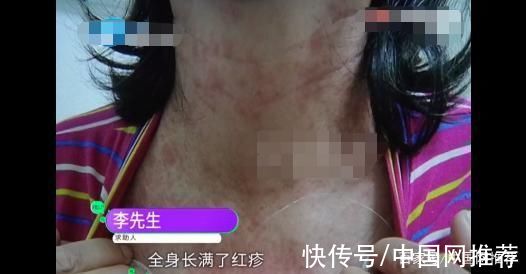 过敏|女子吃完感冒药被送医急救，只因开药时未表明自己有过敏史