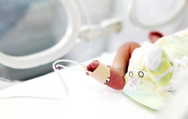 胎儿|早产儿仅1斤，医生称存活几率低，宝宝的举动感动众人