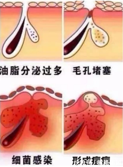 毛孔|护肤顺序不对,用再贵的神仙水都没用!正确护肤步骤新手别错过
