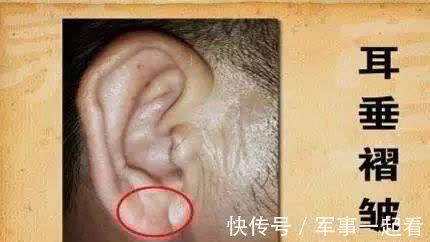 血管堵塞|血脂偏高的人，头部或有4个表现，若想调节血脂，给你2个小建议