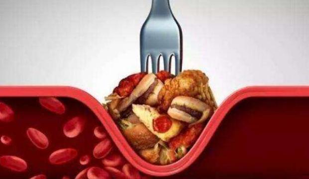 动脉粥样硬化斑块|终于找到高血脂的真凶了！医生四大错误观念，早改早安全