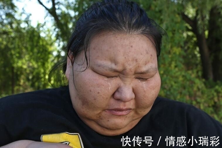 女孩|95后女孩体重400斤,睡觉时把床压塌,现在她的变化让无数人惊叹