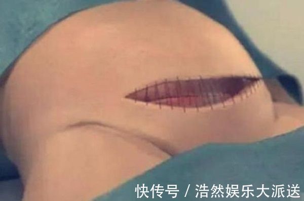 孩子|剖腹产只是“挨一刀”就完事看完手术全过程,忍不住心疼女人