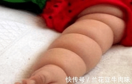 莲藕臂|孩子出生就是“莲藕臂”, 家人夸太可爱, 医生检查后大骂父母无知