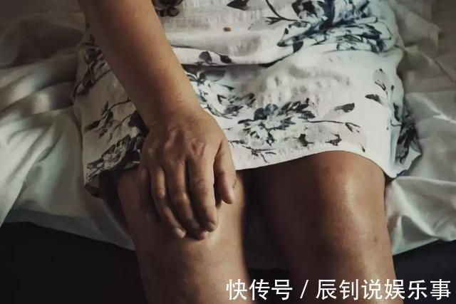 糖友|它已超过糖尿病,成为我国第二大慢性疾病!再不注意就晚了