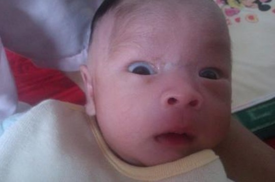 用力过猛|孩子三个月不会笑,奶奶却说是当领导的命,检查后医生却摇头