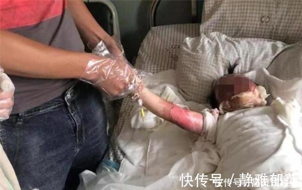 陌生人|男孩掉进180度油锅,奶奶神反应救孩子一命,医生都夸她高明!
