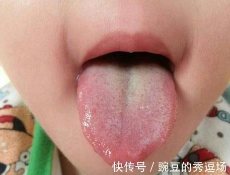 儿科医生|6岁女娃查出脾胃衰竭，医生：煮粥常放它，脾胃怎能“扛”的住