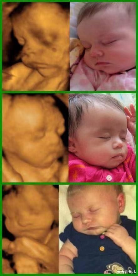 家属|为何有的医院做四维彩超不让家属陪?3大原因,孕妇有权知道