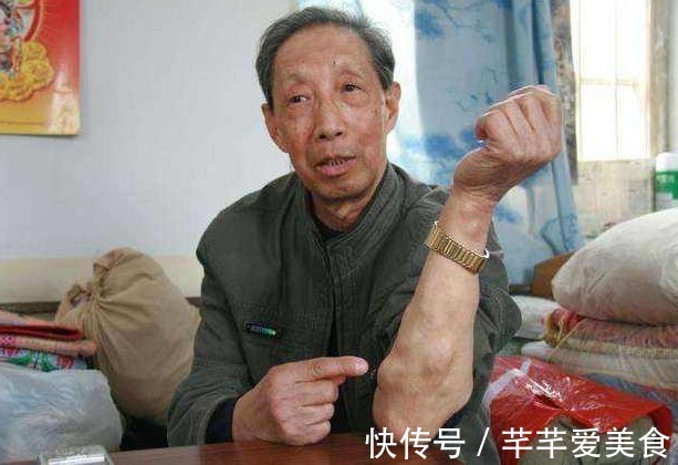 局部|以下5种症状不断发生,十有八九就是癌,最好去检查一下