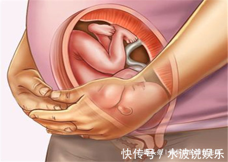 入盆|入盆后是不是就要生了要多久才会生