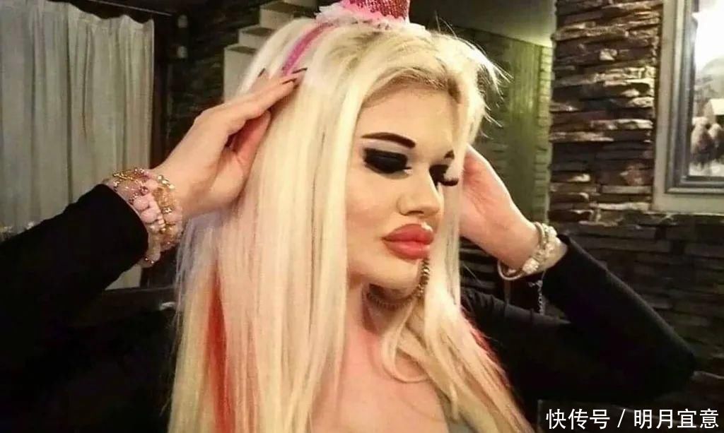 21次丰唇手术之后,这个妹子的嘴唇现在长这样…