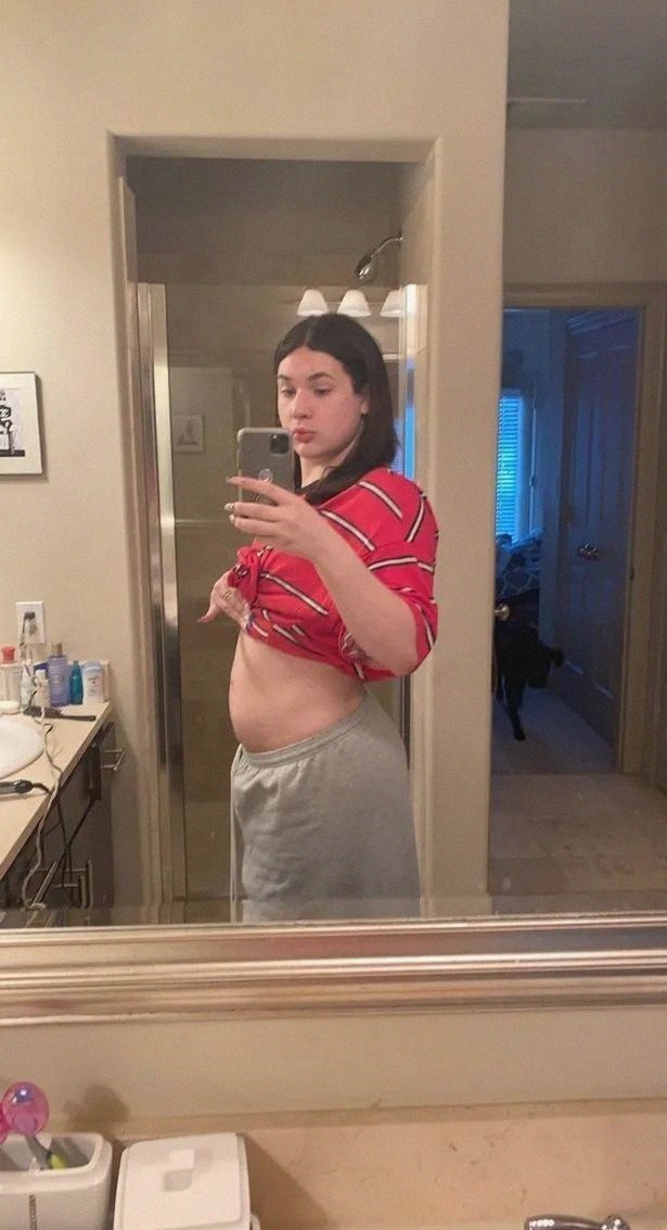 女孩|体内是女孩,体外是男孩。18岁男生发现自己拥有女性繁殖系统