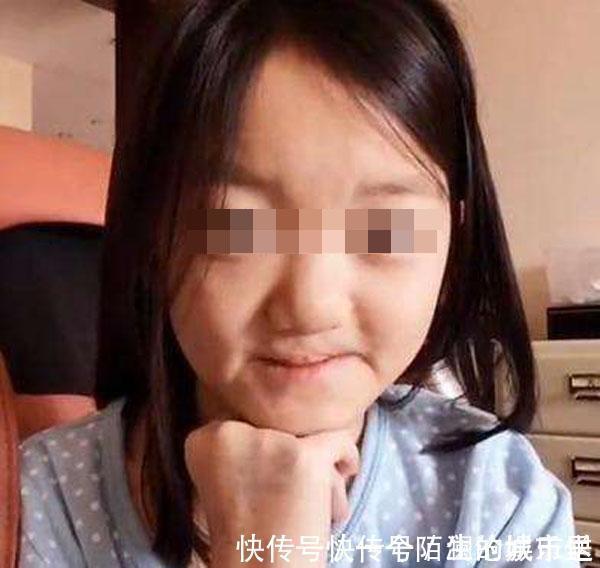 兔唇|医生三类孕妇容易生“兔唇”宝宝,如果你在其中,就要小心了